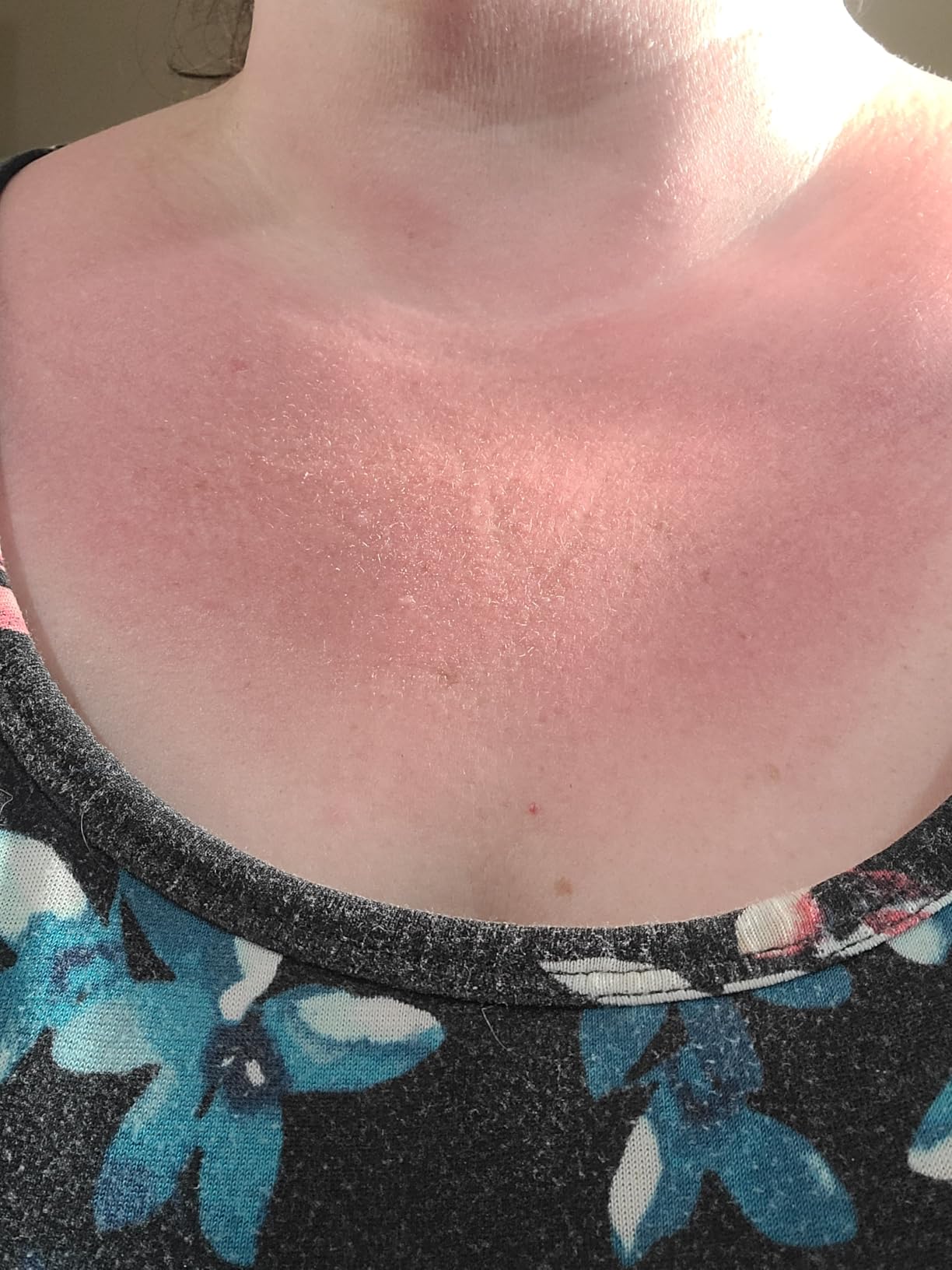 Burt's Bees After Sun Lotion with Hydrating Aloe Vera and Coconut Oil, Replenish and Recondition skin, Sunburn Relief, Natural Origin After Sun Soother, 6 oz. Tube customer photo 2