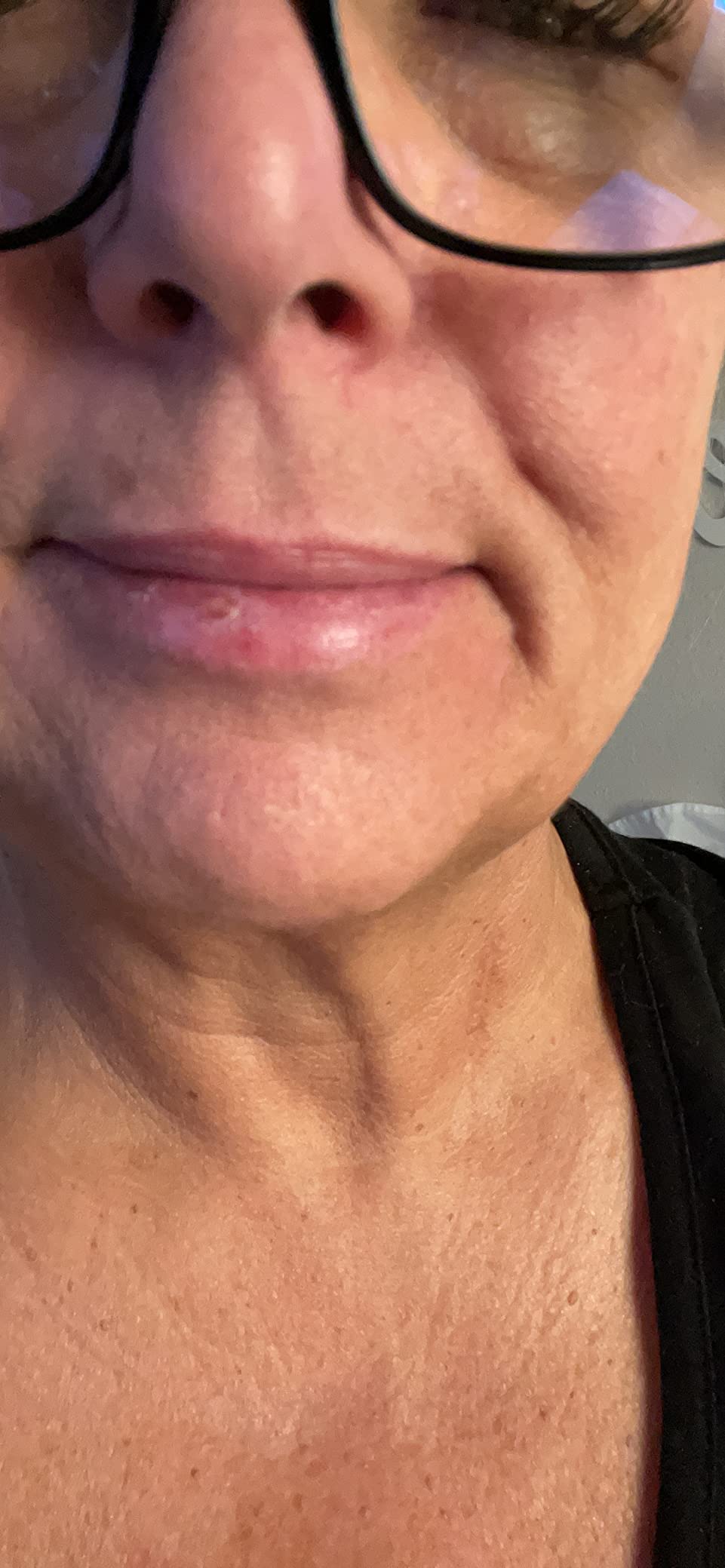EltaMD UV Lip Balm Sunscreen, Transparent Zinc Oxide, SPF 30 | Restores Natural Softness and Hydrates, Protects Chapped, Dry, and Cracked Lips, Sheer Finish, Water Resistant Up to 80 Min. customer photo 1