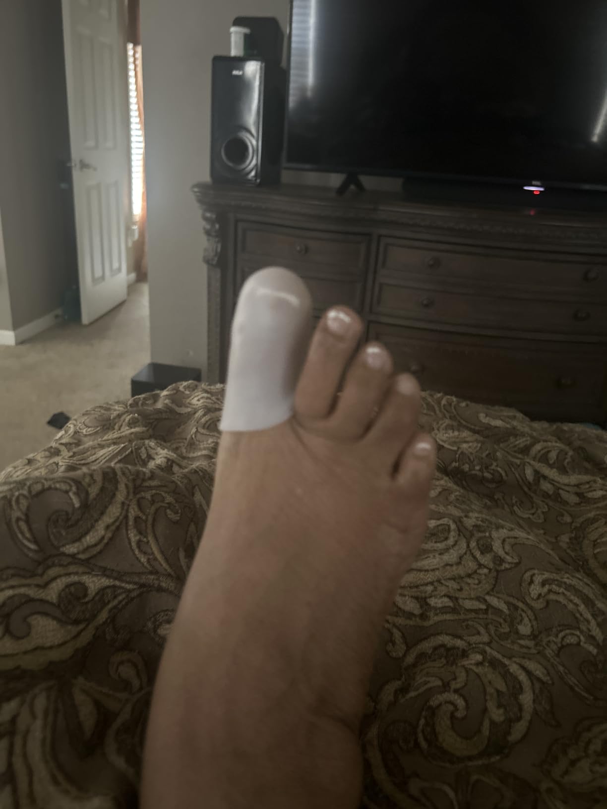 Dr. Frederick's Original Soft Gel Toe Caps, White, Large, 6 ct - Doctor-Developed for Blisters, Corns, Ingrown Toenails, In-Shoe Toe Protection customer photo 1