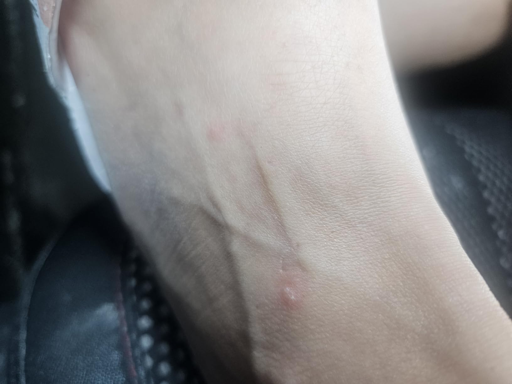 Badger Bug Bite Itch Relief Stick, Natural & Organic Anti Itch Cream for Bug Bites, Rashes & Poison Ivy, Fast Itchy Skin Relief After Bite, .6 oz customer photo 1