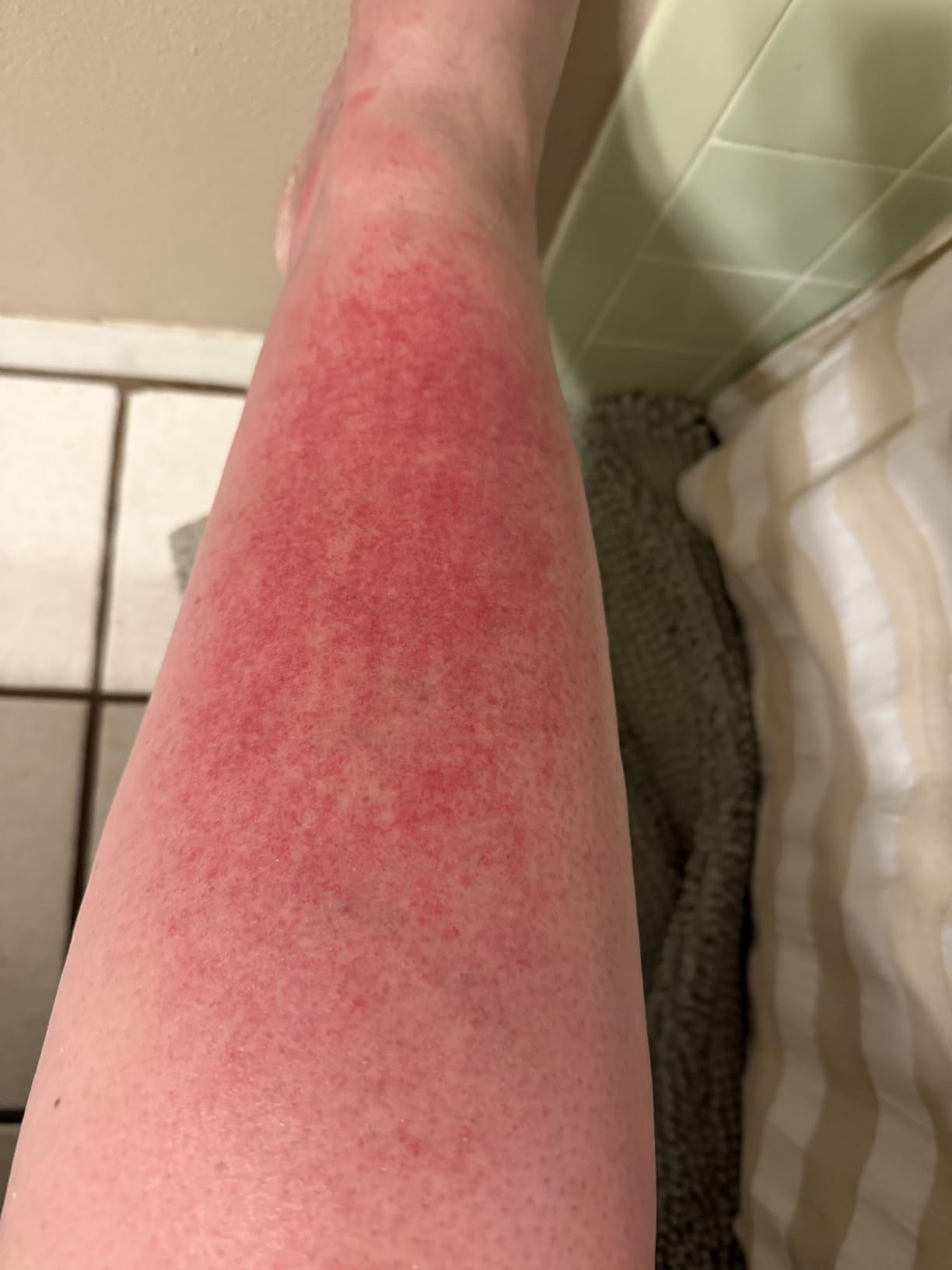 Neutrogena Sun Rescue After Sun Replenishing Lotion with Aloe Vera, Mint Extract, & Vitamin E, 24-Hour Moisture for Healthy Glow for Sensitive Skin, Vegan, Non-Comedogenic Lotion, 6.7 oz customer photo 1