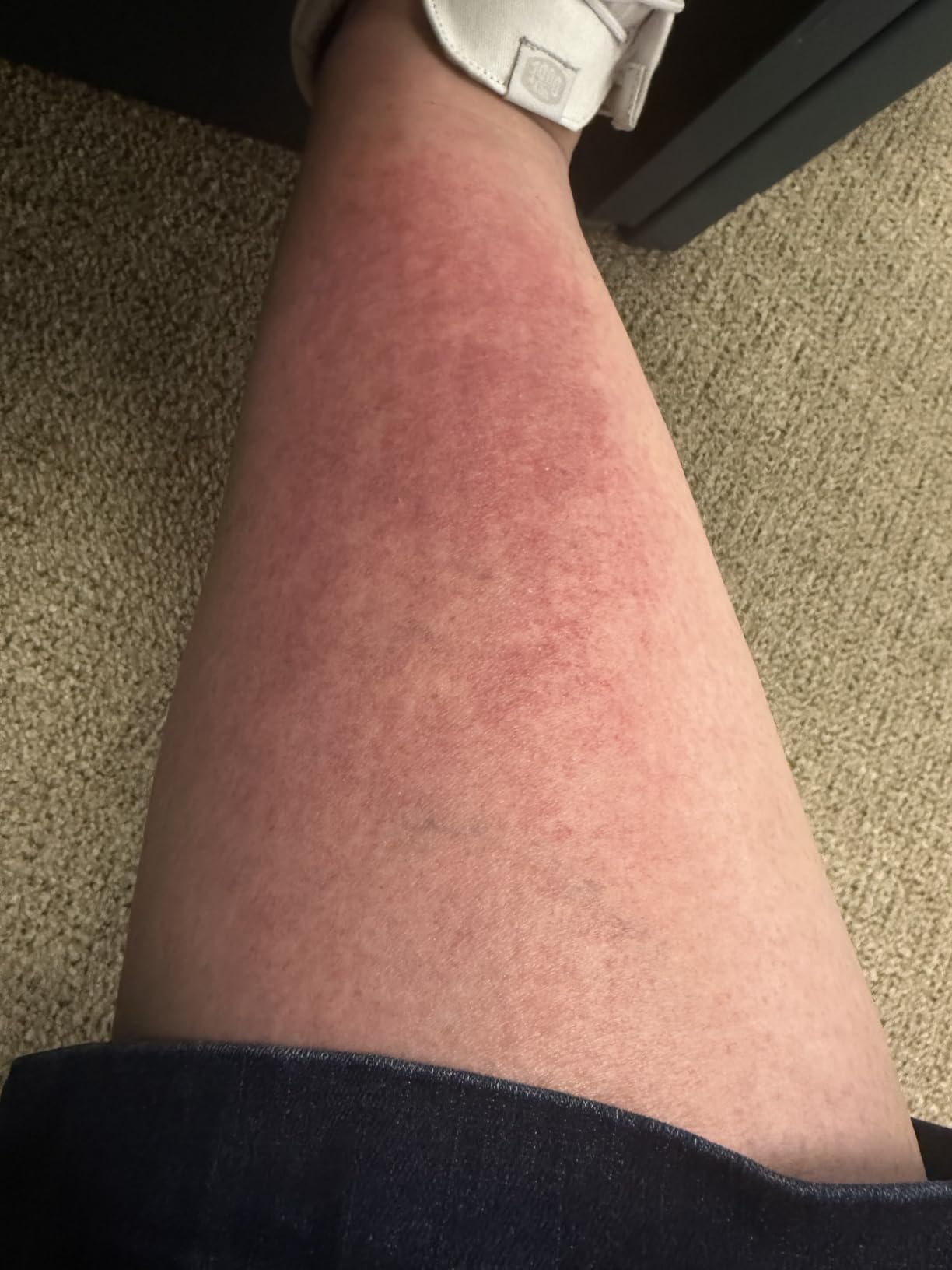 Neutrogena Sun Rescue After Sun Replenishing Lotion with Aloe Vera, Mint Extract, & Vitamin E, 24-Hour Moisture for Healthy Glow for Sensitive Skin, Vegan, Non-Comedogenic Lotion, 6.7 oz customer photo 2