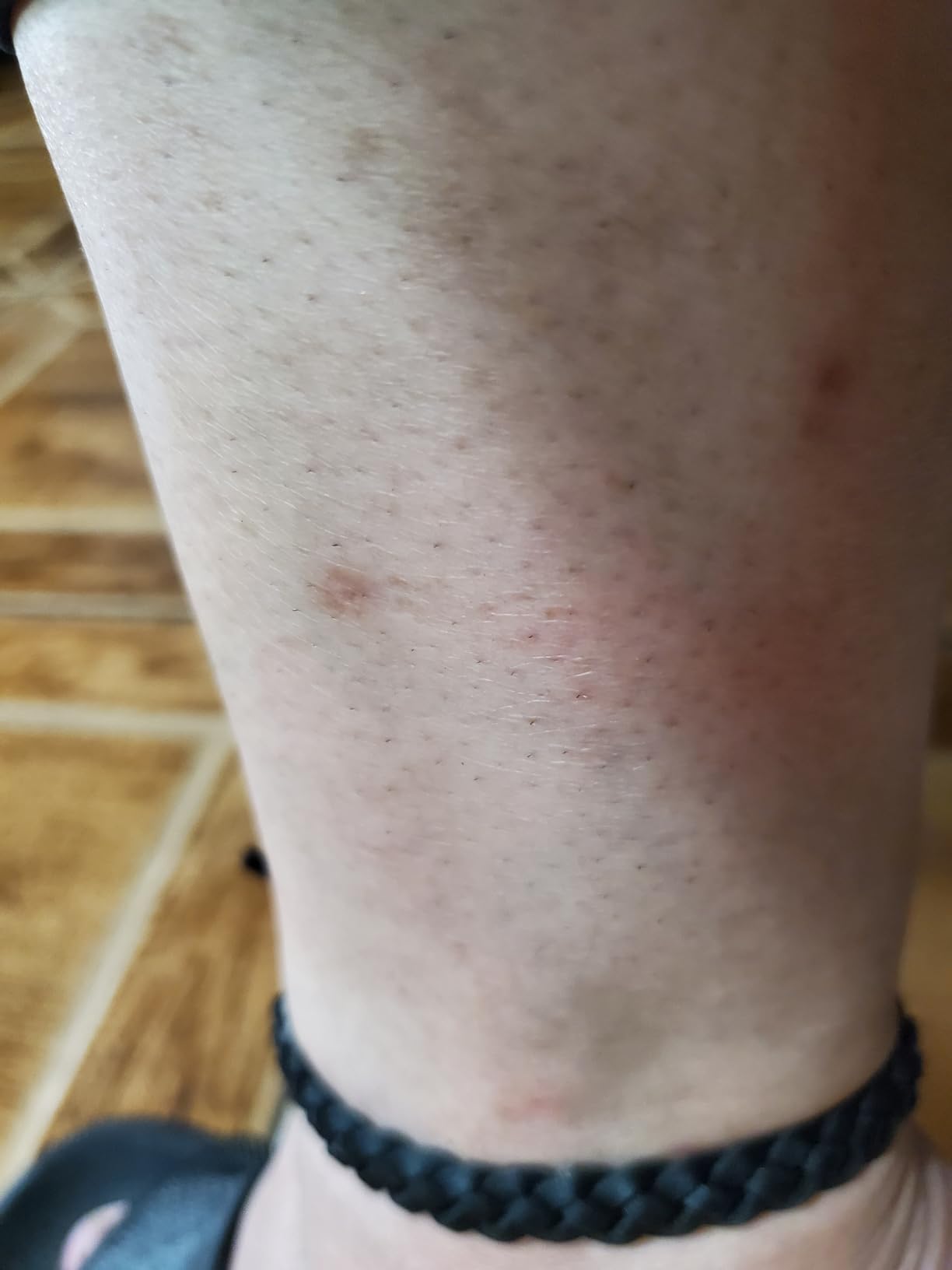 Bear Grylls Mosquito Repellent Bracelets | DEET-Free | 10 Pack customer photo 1