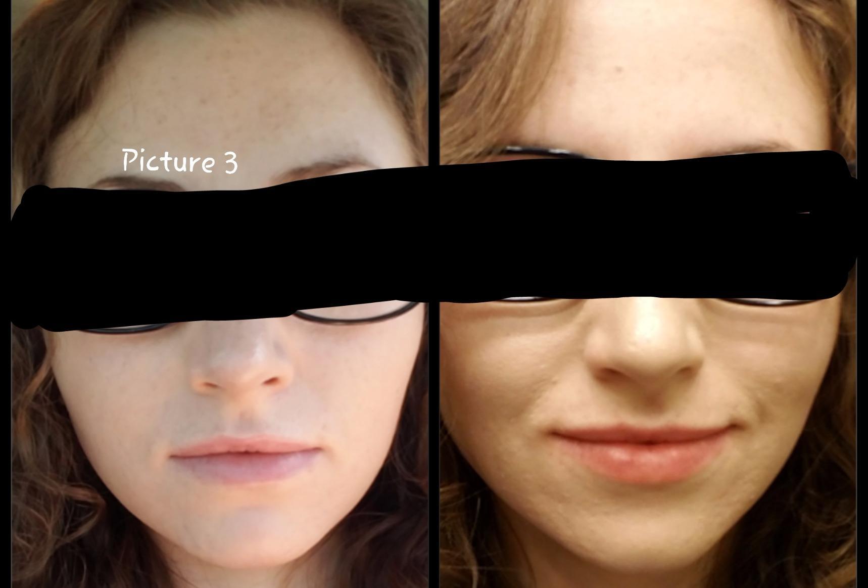 CeraVe Renewing Salicylic Acid Cleanser, Gentle Exfoliating Face Wash, 16oz customer photo 2