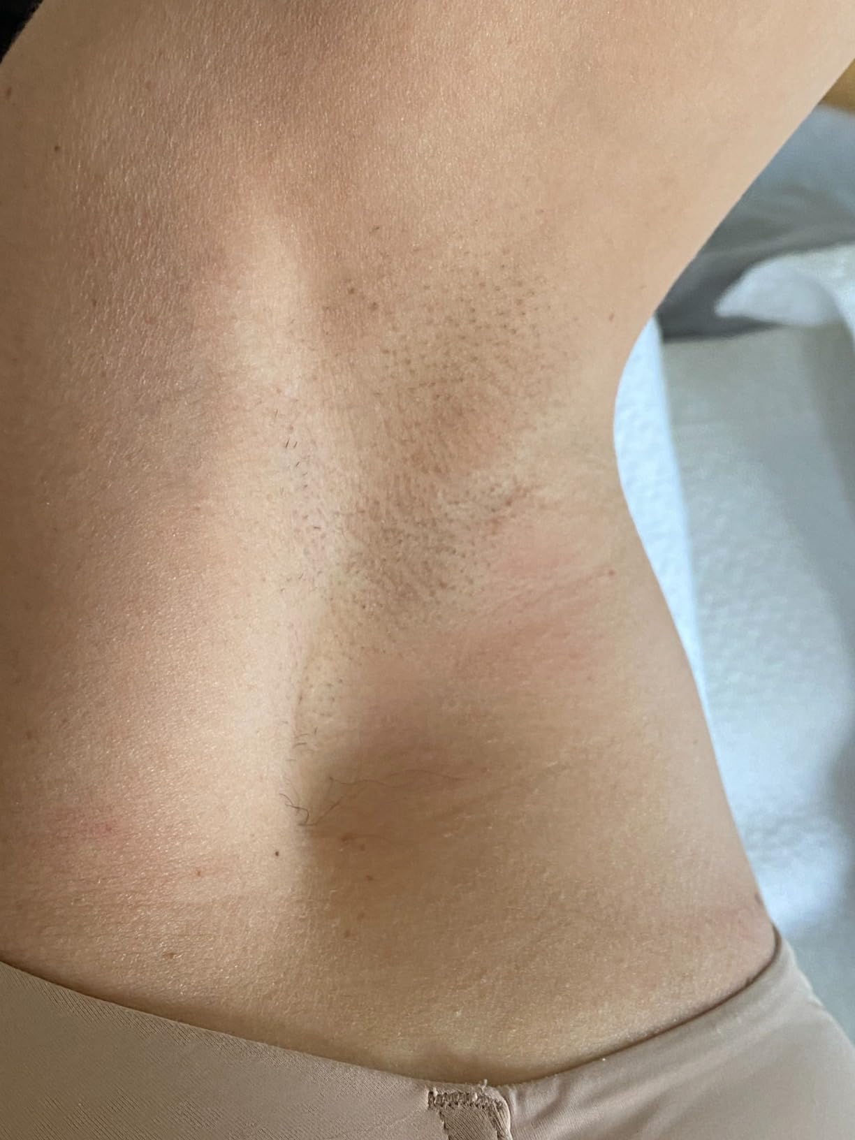 Braun IPL, Silk·Expert Pro 5, IPL Hair Removal for Women and Men, Permanent Laser Hair Reduction At-Home, 4 Heads, IPL5347 customer photo 2